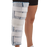 Cutaway Knee Immobilizer with Patella Strap