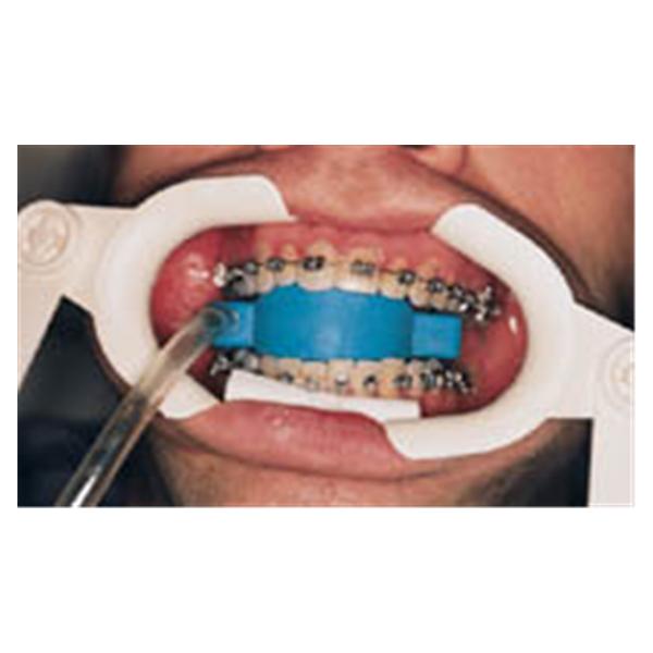 Ortho Arch Cotton Mouth Prop Ea