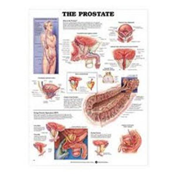 Wolters Kluwer Health  Chart Anatomical Prostate Laminated 20x26" Ea