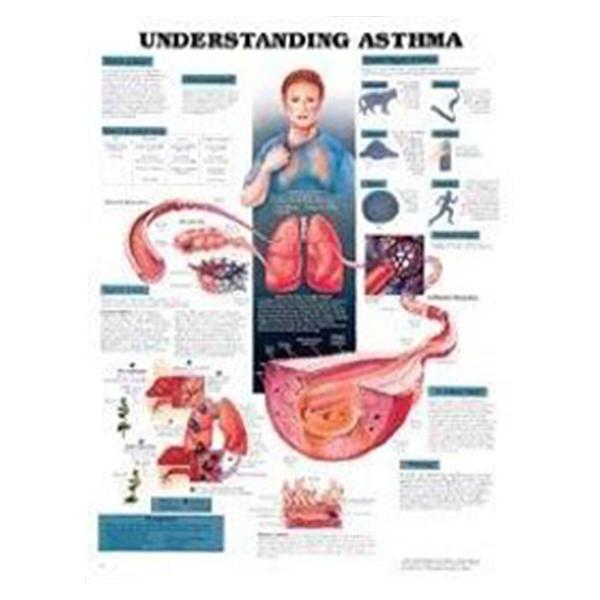 Wolters Kluwer Health  Chart Educational Understanding Asthma 20x26" EA