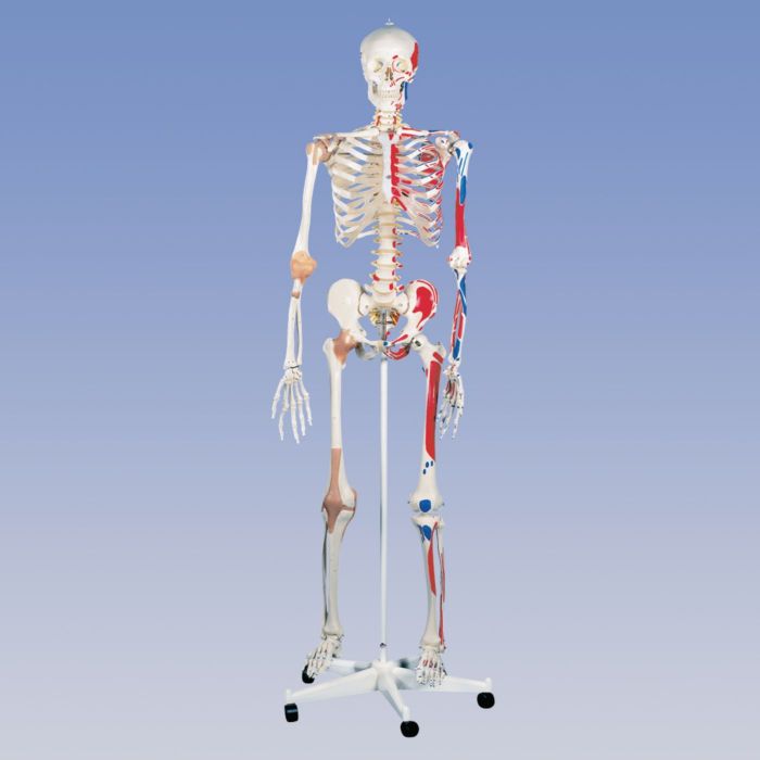 Patterson Medical Deluxe Skeleton - Pelvic Mounted