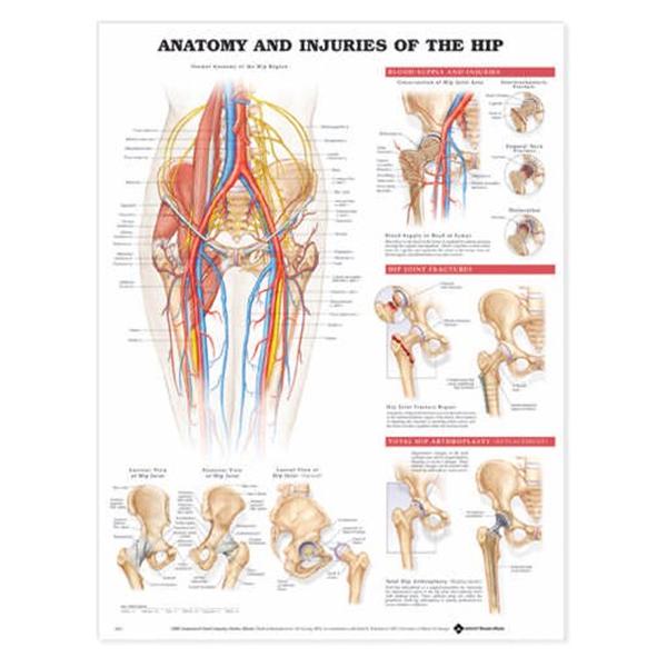 Wolters Kluwer Health  Chart Anatomical Anatomy and Injuries of the Hip 20x26" Ea