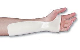 Radial Bar Wrist Precut Cock-Up Splints