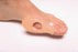 AliMed Bunion Shield - Bunion Shield, Universal - 60762