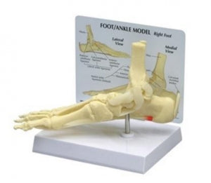 Alimed Plantar Fasciitis Foot and Ankle Anatomical Model - Foot and Ankle Anatomical Model - 70574