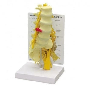 GPI Anatomicals Lumbar with Sacrum Model - MODEL LUMBAR W / SACRUM - 1700