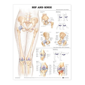 AliMed Anatomical Wall Charts - Anatomical Wall Chart, Hip and Knee - 73456