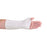 Kinetec Arizona Solid Splints - Arizona Splint in White, 2.4 mm Thick, 18" x 24" Standard Size, Solid - M1AN3S00WH