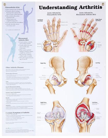 North Coast Medical Anatomical Wall Charts, Vinyl-Laminated