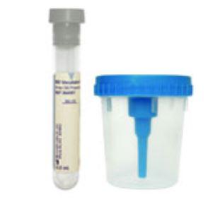 BD Vacutainer Urine Collection Kits by BD