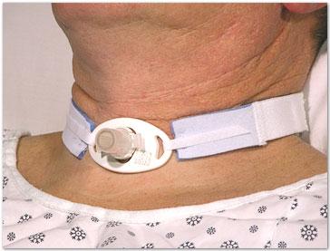 Tracheostomy Tube Holders by Dale