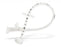 Bard Percutaneous Endoscopic Gastrostomy (PEG) Kits - Ponsky-Gauderer Silicone Feeding Kit, 20 Fr - 000329