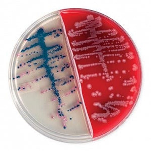 BD Neisseria Meningitidis Antiserum - VIAL, N MENINGITIDIS ANTISER, GRP A 100 - 241110