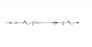 B Braun SafeDAY IV Administration Sets - SafeDAY IV Administration Set; 15 Drops per mL; 23 mL Priming Volume; Universal Spike; Back-Check Valve; SafeDAY Valves 100" and 6" Above Distal End; 125"L - 362006