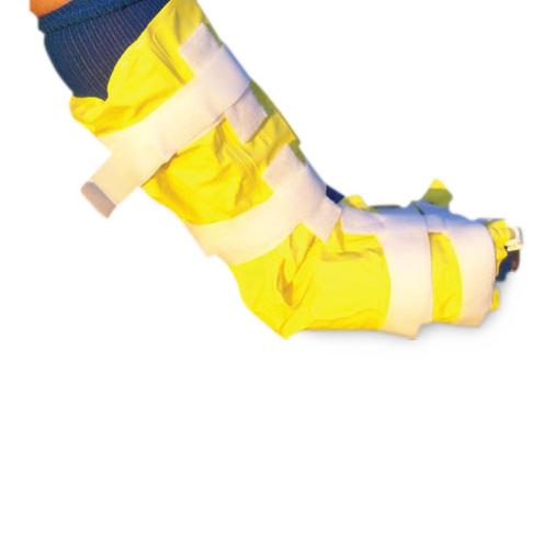 Custom Splinting Materials