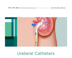 CR Bard TIGERTAIL Ureteral Catheters - Ureteral Open Tip Catheter, Left / Right, 5 Fr - 134005