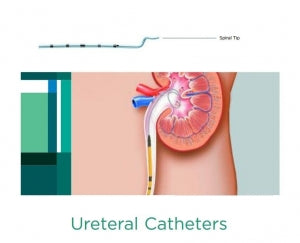 CR Bard Woven Ureteral Catheters - Ureteral Catheter, Spiral, 4 Fr - 137504