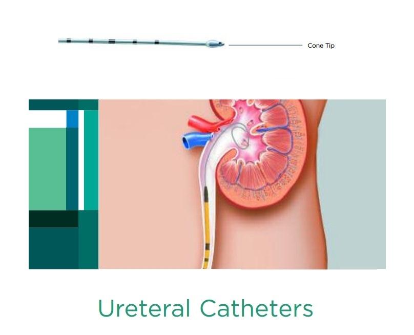 Polyurethane Ureteral Catheter by CR Bard