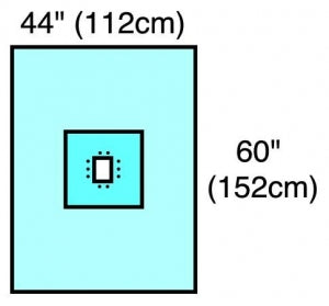 Cardinal Health Tiburon Neonatal Drapes - Neonatal Drape, 60" x 43.5" - 29494