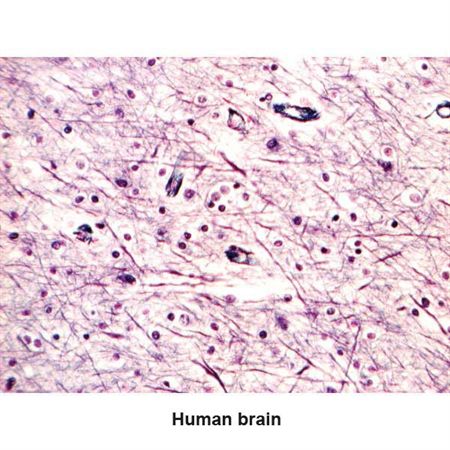 Bodian Stain Kit Alzheimer Control Slides