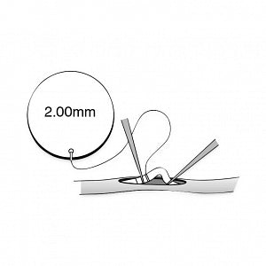 Chase Medical Sof-Flo Atraumatic Coronary Artery Shunts - Vessel Shunt, 2 mm Taper Tip, 12 mm Shaft - SHT-1220S