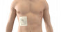 BD PleurX Pleural Catheter Kits - PleurX Catheter Access Kit - 50-7280