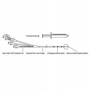 Conmed Stone Removal Balloons - Biliary Retrieval Balloon Catheter, 8 ...