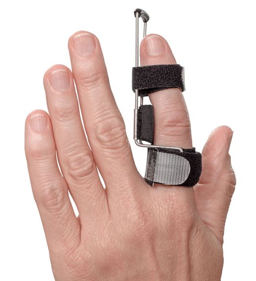 Step Splint 