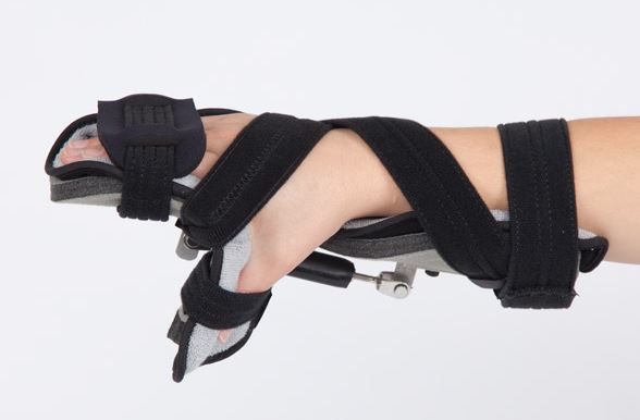 Turnbuckle Orthosis 