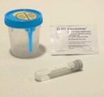 BD Vacutainer Urine Collection Kits - DBD-KIT, COLLECTION, VACUTAINER - 364989