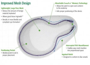 BD Modified Onflex Mesh for Preperitroneal Hernia - Modified Onflex Preperitroneal Hernia Mesh, Medium, 3.4'' x 5.6'' - 0115410