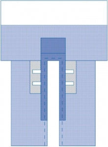 Medline Sterile CV Split Surgical Drape with Clear Anesthesia Pouch - Sterile Cardiovascular Split Drape with 2 Pouches and Clear Anesthesia Screen, 102" x 135" x 87" - DYNJP4008