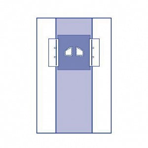 Medline Sterile Special Procedure Surgical Drape - Tunneled Catheter / Port Insertion Drapes, 83" x 145" (211 cm x 318 cm) - DYNJP4131