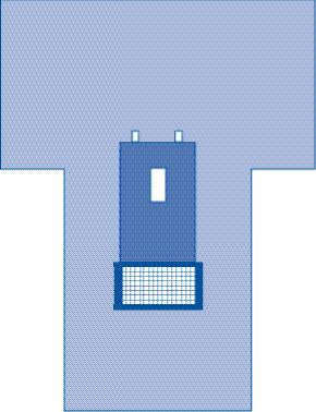 Sterile Cystoscopy Surgical Pack V