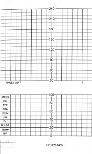 Graphic Controls Medical Chart Recording Papers - HP Fetal ECG Paper Roll, 151 mm x 50' - 7G10643709