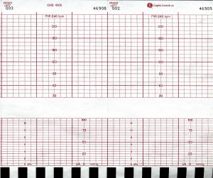 Graphic Controls Medical Chart Recording Papers - Fetal Monitor Recording Paper, Z-Fold, Red Grid, CMS 4305, 152 mm x 47' - 7G30597226