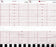 Graphic Controls Medical Chart Recording Papers - Fetal Monitor Recording Paper, Z-Fold, Red Grid, CMS 4305, 152 mm x 47' - 7G30597226