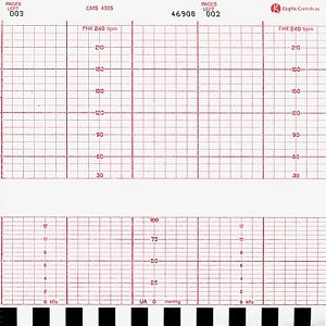 Graphic Controls Medical Chart Recording Papers - Corometrics Fetal Monitor Recording Paper, Z-Fold, Red Grid, 152 mm x 47' - 7G30597226