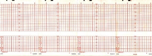 Graphic Controls Medical Chart Recording Papers - HP Fetal Monitor Recording Paper, Fan-Fold, Orange Grid, 5.894" x 49' - 7G30748696