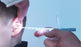 Bionix Lighted Articulating Ear Curettes - Ear Curette, Infant Scoop, Lighted - 2260