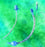 Teleflex Medical Cuffed Endotracheal Tubes - Cuffed Endotracheal Tube, Oral / Nasal, 5.0 mm - 5-12610