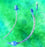 Teleflex Medical Cuffed Endotracheal Tubes - Cuffed Endotracheal Tube, Oral / Nasal, 5.5 mm - 5-12611