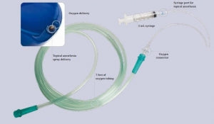 Teleflex Medical LMA MADgic Airway Device - Atomizing Airway with 5 mL Syringe and Tubing - MAD780