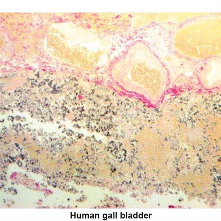 Hall's Bile Stain Kit Pint Kit