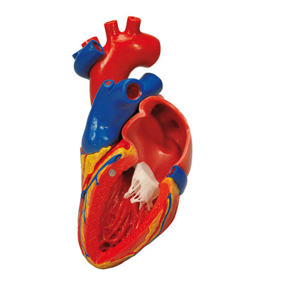 Heart with Bypass, 2-Part