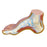 Hollow Foot (Pes Cavus)