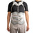 TLSO Lumbosacral Bracing System by Aspen Medical