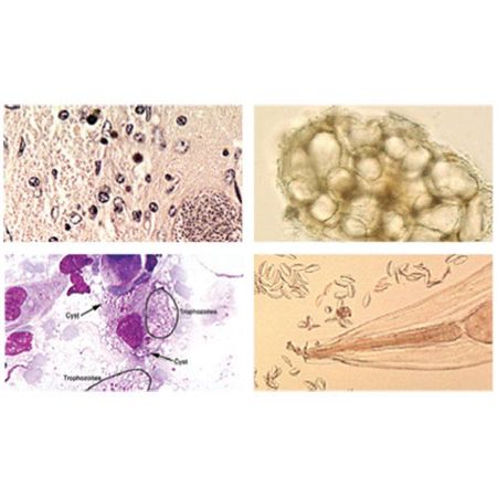 Parasitology Image Atlas Site License