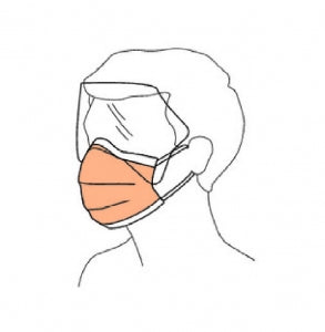 Halyard FLUIDSHIELD Level 3 Surgical Mask with Wrap and Visor - FLUIDSHIELD Fog-Free Antiglare Mask with Ear Loops, Orange - 47147