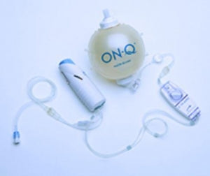 Halyard Health On-Q Painbuster Kits - On-Q Painbuster Kit with Silver Soaker Catheter 10 - PM012-A